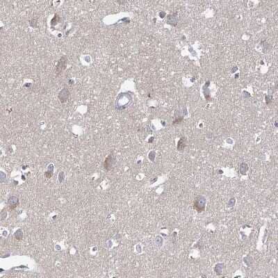 Immunohistochemistry-Paraffin: ARHGAP44 Antibody [NBP1-93624]