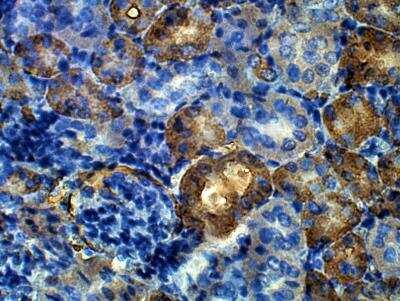 Immunohistochemistry-Paraffin: ARHGAP44 Antibody [NBP3-12288]