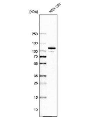 Western Blot: ARHGAP44 Antibody [NBP1-93624]