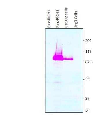 Western Blot: ARHGAP44 Antibody [NBP3-12288]