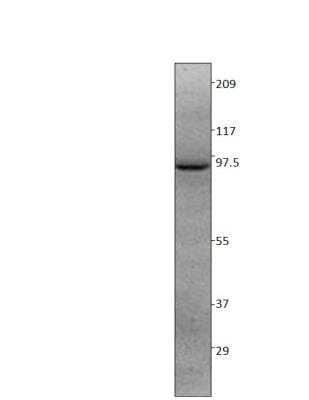 Western Blot: ARHGAP44 Antibody [NBP3-12288]