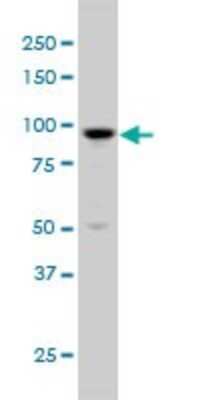 Western Blot: ARHGAP6 Antibody (6B3) [H00000395-M01]