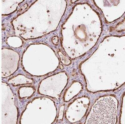 Immunohistochemistry-Paraffin: ARHGAP6 Antibody [NBP2-49417]