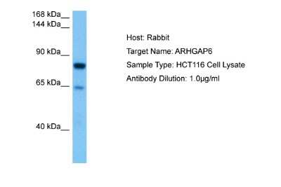 Western Blot: ARHGAP6 Antibody [NBP2-87029]