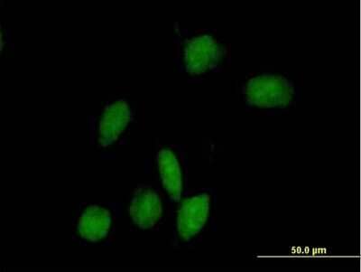 Immunocytochemistry/ Immunofluorescence: ARHGAP9 Antibody [H00064333-B01P]