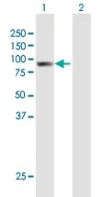 Western Blot: ARHGAP9 Antibody [H00064333-B01P]