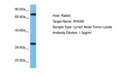 Western Blot: ARHGAP9 Antibody [NBP2-86580]