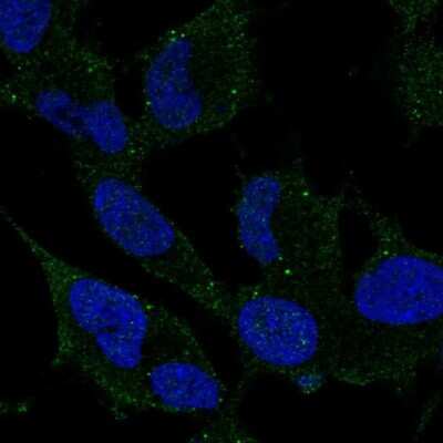 Immunocytochemistry/ Immunofluorescence: ARHGDIG Antibody [NBP2-69064]