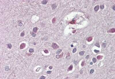 Immunohistochemistry-Paraffin: ARHGDIG Antibody [NBP1-49854]