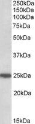 Western Blot: ARHGDIG Antibody [NBP1-49854]