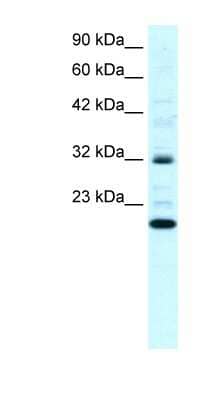 Western Blot: ARHGDIG Antibody [NBP1-59112]