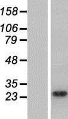 Western Blot: ARHGDIG Overexpression Lysate [NBP2-08228]