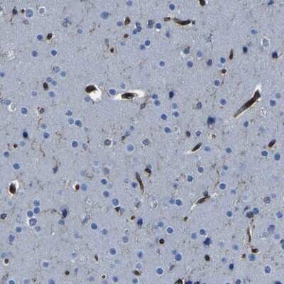 Immunohistochemistry-Paraffin: ARHGEF1 Antibody [NBP1-82843]