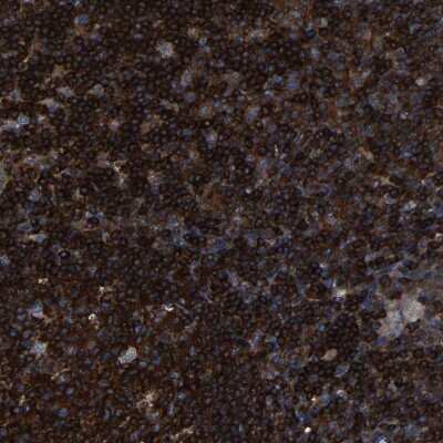 Immunohistochemistry-Paraffin: ARHGEF1 Antibody [NBP1-82843]