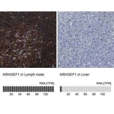 Immunohistochemistry-Paraffin: ARHGEF1 Antibody [NBP1-82843]