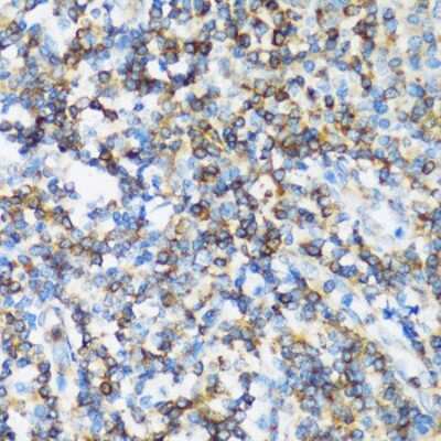 Immunohistochemistry-Paraffin: ARHGEF1 Antibody - Azide and BSA Free [NBP2-92963]