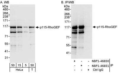 Immunoprecipitation: ARHGEF1 Antibody [NBP1-46830]