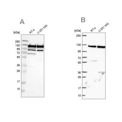 Western Blot: ARHGEF1 Antibody [NBP1-82843]