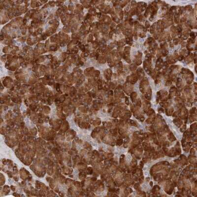 Immunohistochemistry-Paraffin: ARHGEF10L Antibody [NBP1-90432]