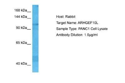 Western Blot: ARHGEF10L Antibody [NBP2-87031]