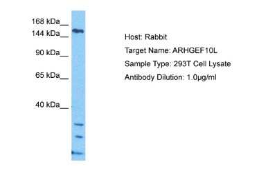 Western Blot: ARHGEF10L Antibody [NBP2-87032]