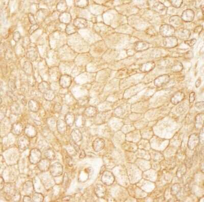 Immunohistochemistry-Paraffin: ARHGEF11 Antibody [NBP1-06553]