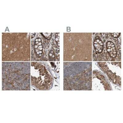 Immunohistochemistry-Paraffin: ARHGEF11 Antibody [NBP1-83313]