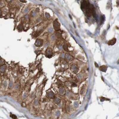 Immunohistochemistry-Paraffin: ARHGEF11 Antibody [NBP1-83313]
