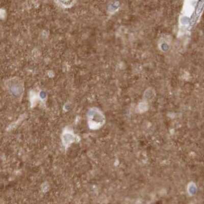 Immunohistochemistry-Paraffin: ARHGEF11 Antibody [NBP1-83313]