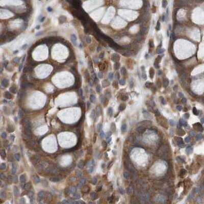 Immunohistochemistry-Paraffin: ARHGEF11 Antibody [NBP1-83313]