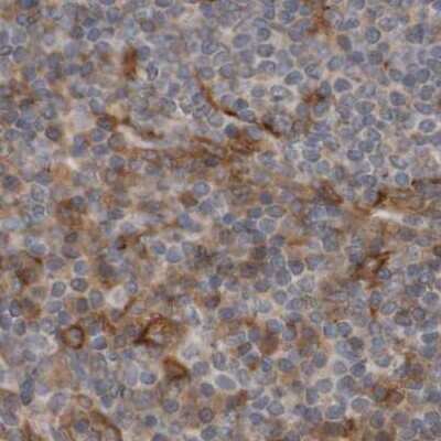 Immunohistochemistry-Paraffin: ARHGEF11 Antibody [NBP1-83313]