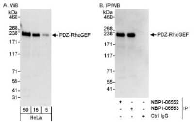 Western Blot: ARHGEF11 Antibody [NBP1-06553]