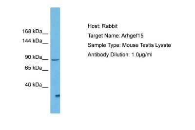 Western Blot: ARHGEF15 Antibody [NBP2-84454]