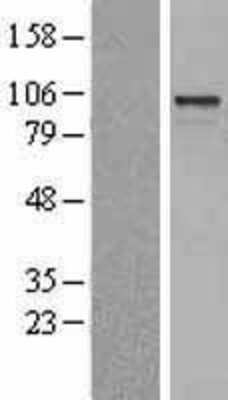 Western Blot: ARHGEF15 Overexpression Lysate [NBL1-07679]