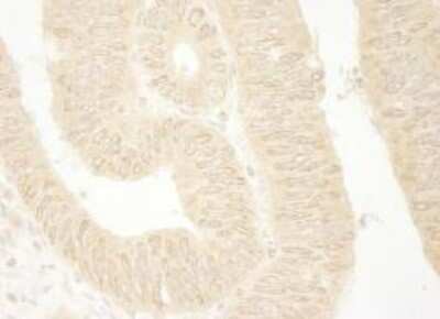 Immunohistochemistry-Paraffin: ARHGEF16 Antibody [NBP1-06499]