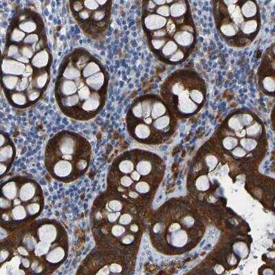 Immunohistochemistry-Paraffin: ARHGEF16 Antibody [NBP1-83372]