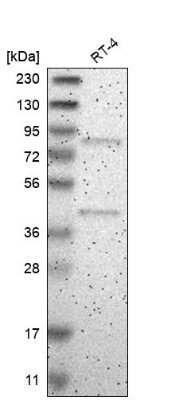 Western Blot: ARHGEF16 Antibody [NBP1-83372]