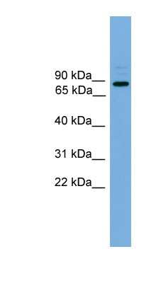 Western Blot: ARHGEF19 Antibody [NBP1-57038]