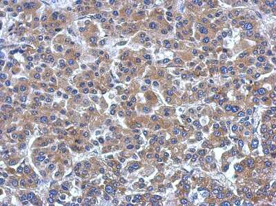 Immunohistochemistry-Paraffin: ARHGEF3 Antibody [NBP2-15456]