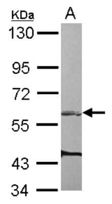 Western Blot: ARHGEF3 Antibody [NBP2-15456]