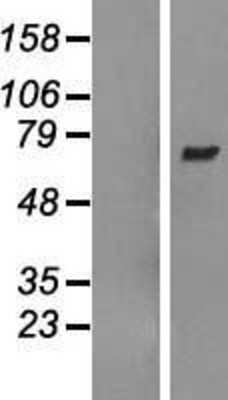 Western Blot: ARHGEF3 Overexpression Lysate [NBL1-07681]