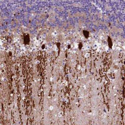 Immunohistochemistry: ARHGEF33 Antibody [NBP2-58937]