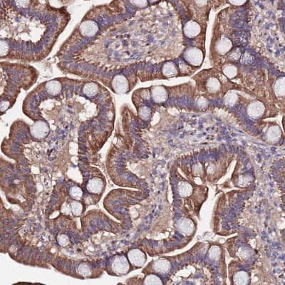 Immunohistochemistry: ARHGEF35 Antibody [NBP2-33446]