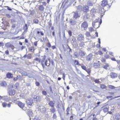 Immunohistochemistry: ARHGEF35 Antibody [NBP2-46718]