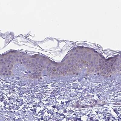 Immunohistochemistry-Paraffin: ARHGEF37 Antibody [NBP2-33405]