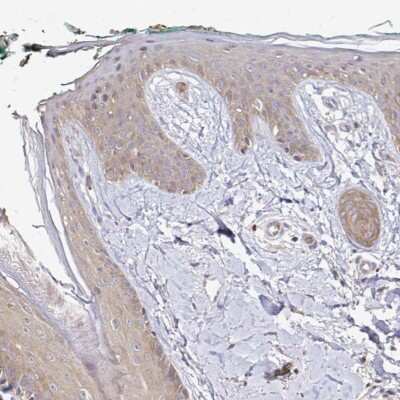 Immunohistochemistry-Paraffin: ARHGEF37 Antibody [NBP2-55383]