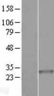 Western Blot: ARHGEF38 Overexpression Lysate [NBP2-06942]