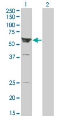 Western Blot: ARHGEF5 Antibody (3A12-B5) [H00007984-M01]