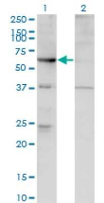 Western Blot: ARHGEF5 Antibody (4D10-D11) [H00007984-M02]