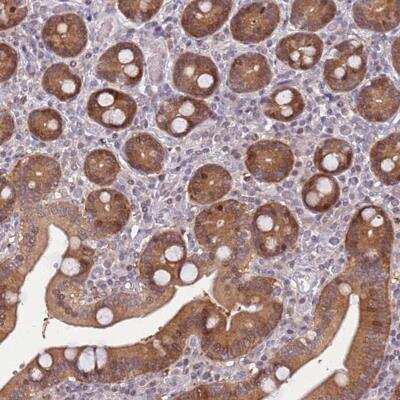 Immunohistochemistry: ARHGEF5 Antibody [NBP2-46701]